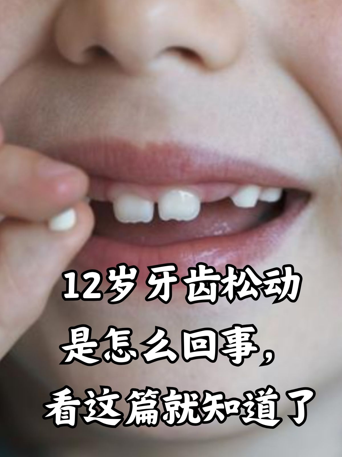 如何让松动的牙齿变坚固